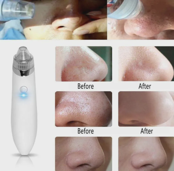 Вакуумный очиститель кожи Beauty Skin Care Specialist / Прибор для чистки лица / 4 насадки продажа и отгрузка кратно коробке кор/60 шт